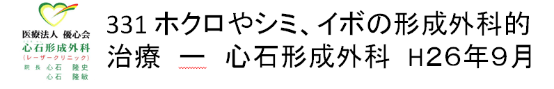 331 ホクロやシミ、イボの形成外科的治療